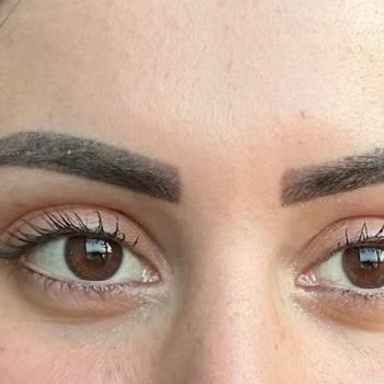 Kaş Pudralama İşlemi Hayal Kırıklığına Uğrattı