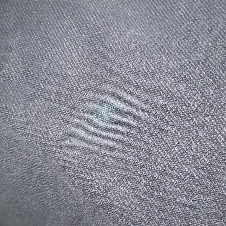 Skechers Eşofman Kalitesizliği Ve Değişim Sorunu