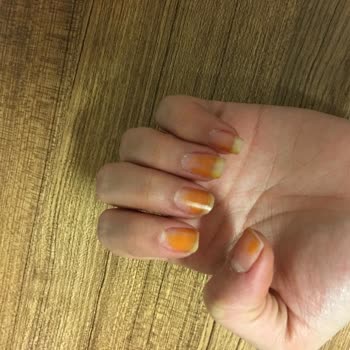 Flormar Kırmızı Oje Tırnakları Turunculaştırıyor!