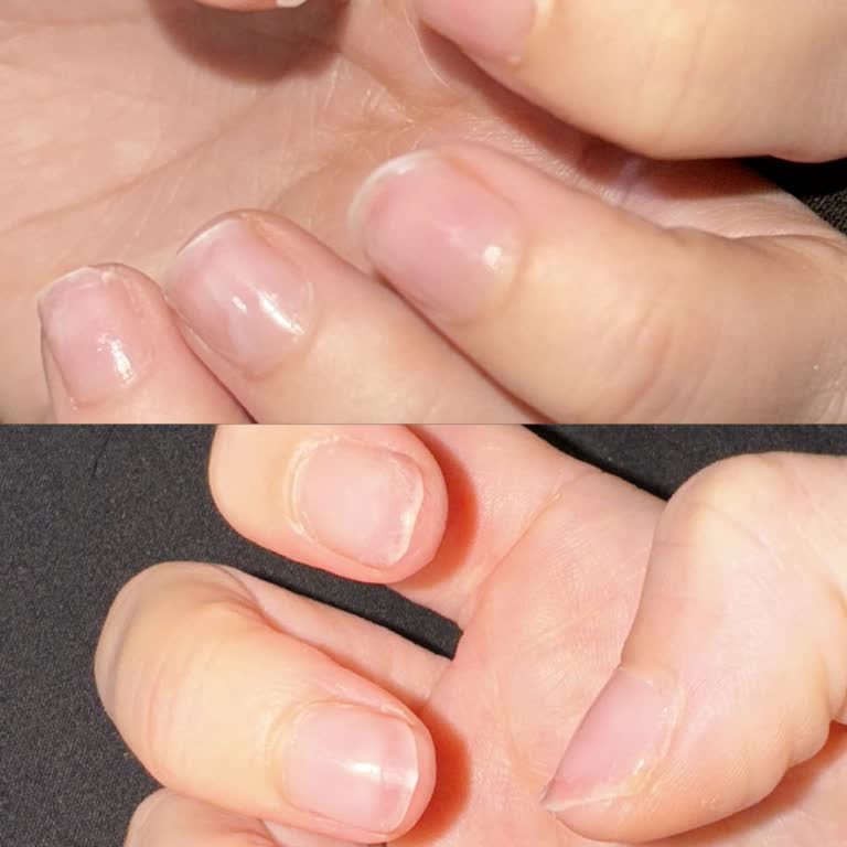 Natural Nail House Protez Tırnak Kabusu: Ağrı Ve Hayal Kırıklığı