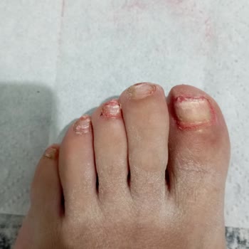 Farma-Tek Opilox Şikayeti!