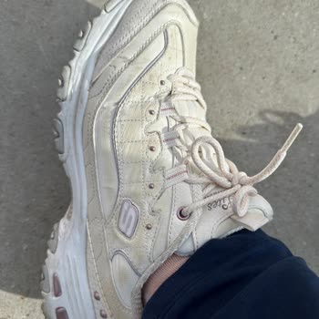 Skechers Ayakkabının Kalite Sorunu Ve Müşteri Hizmetleri Yanıtı