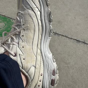 Skechers Ayakkabının Kalite Sorunu Ve Müşteri Hizmetleri Yanıtı