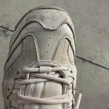 Skechers Ayakkabının Kalite Sorunu Ve Müşteri Hizmetleri Yanıtı