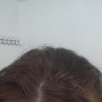 Loreal Boya İle Beklenmedik Sonuç: Açık Kızıl Saçlar Ve Kapanmayan Beyazlar