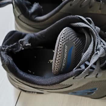 Skechers Ayakkabının Kalite Sorunu Ve Garanti Hayal Kırıklığı