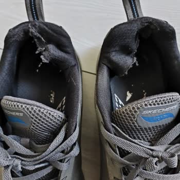 Skechers Ayakkabının Kalite Sorunu Ve Garanti Hayal Kırıklığı