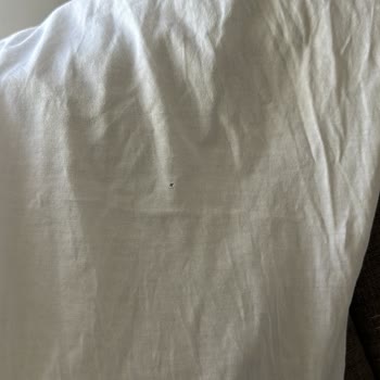 Çamaşır Makinesi Kullanımı Sonrası Yırtılan Kıyafetler Ve Yanıltıcı Servis Hizmeti