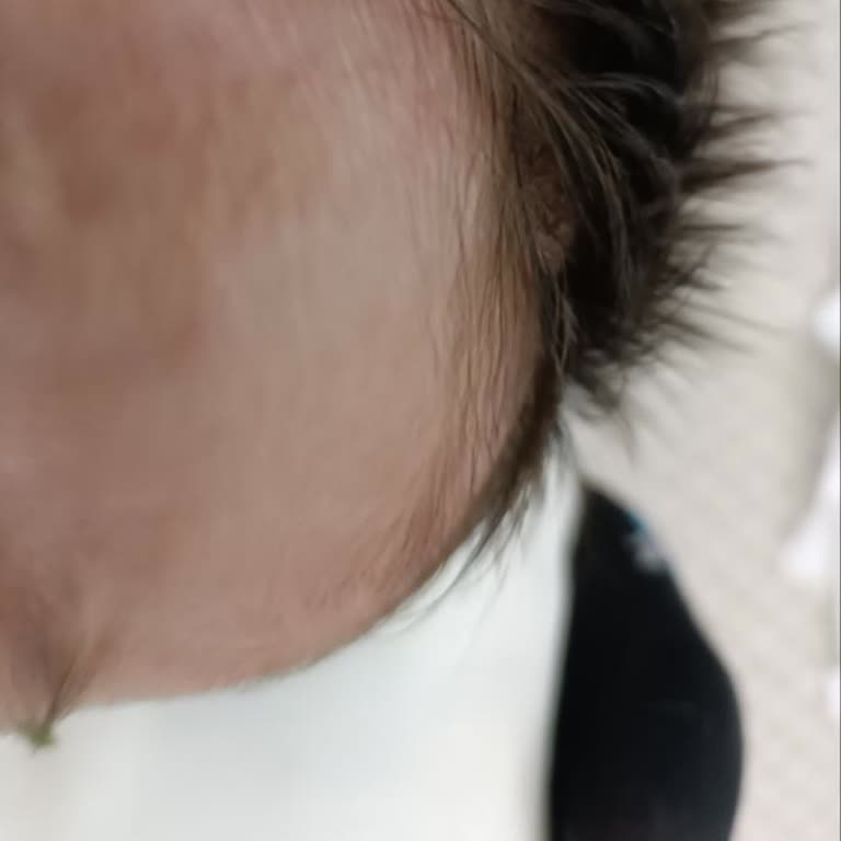 Organik Losyon Bebeğimde Alerji Yaptı