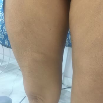 Zeynep & Tülay Beauty Kişiye Özel Değil Deneme Yanılma Usulü Çalışma Sistemi!