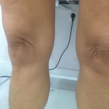 Zeynep & Tülay Beauty Kişiye Özel Değil Deneme Yanılma Usulü Çalışma Sistemi!