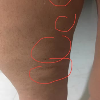 Zeynep & Tülay Beauty Kişiye Özel Değil Deneme Yanılma Usulü Çalışma Sistemi!