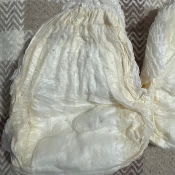 Sleepy Ecologic Bebek Bezlerinde Siyah Noktalar Ve Kötü Koku Sorunu