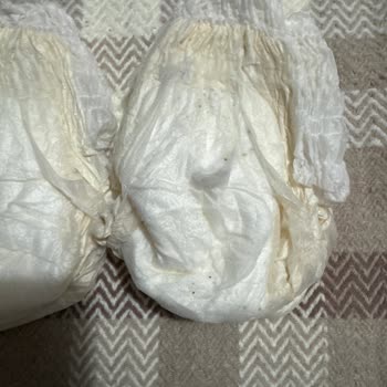 Sleepy Ecologic Bebek Bezlerinde Siyah Noktalar Ve Kötü Koku Sorunu