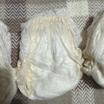 Sleepy Ecologic Bebek Bezlerinde Siyah Noktalar Ve Kötü Koku Sorunu