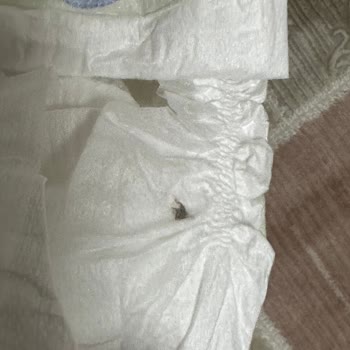Molfix Bebek Bezlerinde Yabancı Cisim Skandalı