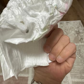 Molfix Bebek Bezlerinde Yabancı Cisim Skandalı