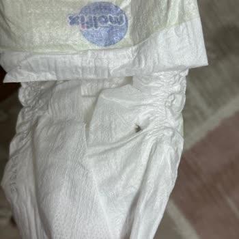 Molfix Bebek Bezlerinde Yabancı Cisim Skandalı