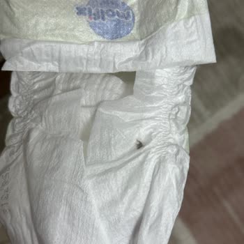 Molfix Bebek Bezlerinde Yabancı Cisim Skandalı