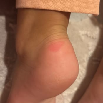 Lumberjack Çocuk Botu: Sorunlu Ürün Ve Yetersiz Müşteri Hizmetleri