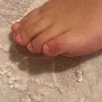 Lumberjack Çocuk Botu: Sorunlu Ürün Ve Yetersiz Müşteri Hizmetleri