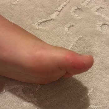 Lumberjack Çocuk Botu: Sorunlu Ürün Ve Yetersiz Müşteri Hizmetleri