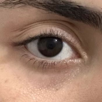 Pahalı Göz Kremi Göz Altlarımı Kötüleştirdi