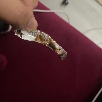 Saloon Burger Sufle Siparişimde Tehlikeli Madde: Sağlığımız Tehlikede!