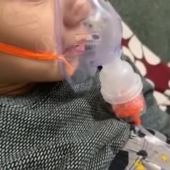 Nimomed Nimo Nebülizatör Buhar Vermiyor