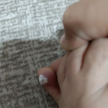 Ayakkabı Sorunu Sağlık Problemlerine Yol Açtı