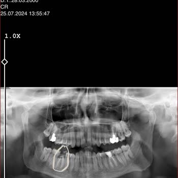 Diş Tedavisinde İlgisizlik Ve Yanlış Yönlendirme