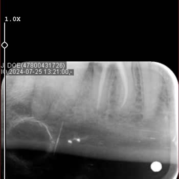 Diş Tedavisinde İlgisizlik Ve Yanlış Yönlendirme