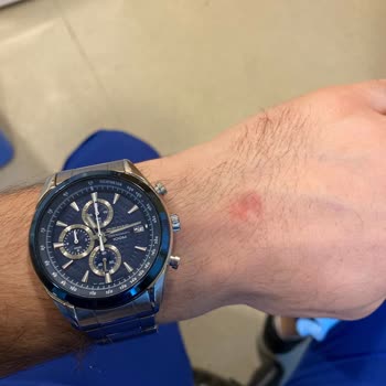 Seiko Watch Design Flaw Makes It Unwearable