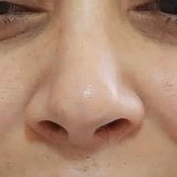 Dr. Bennur Çetindağ Albayrak Burun Ameliyatı Mağduru!