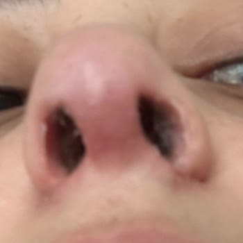 Dr. Bennur Çetindağ Albayrak Burun Ameliyatı Mağduru!