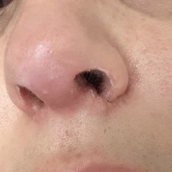 Dr. Bennur Çetindağ Albayrak Burun Ameliyatı Mağduru!