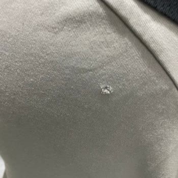 Bosch Çamaşır Makinesi Kumaş Yırtma Sorunu Ve Yetersiz Servis Desteği