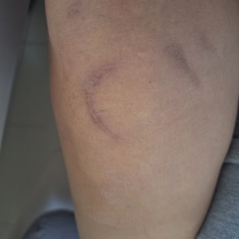 Güvenlik Ve Hizmette Büyük Açıklar