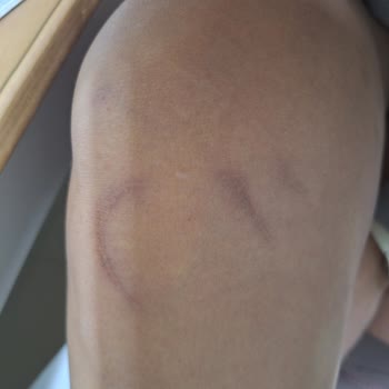 Güvenlik Ve Hizmette Büyük Açıklar