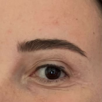 Fbm Tıp Merkezi Beklentilerin Altında Kalan Estetik Deneyimi