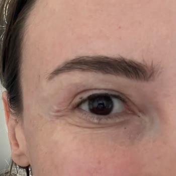 Fbm Tıp Merkezi Beklentilerin Altında Kalan Estetik Deneyimi