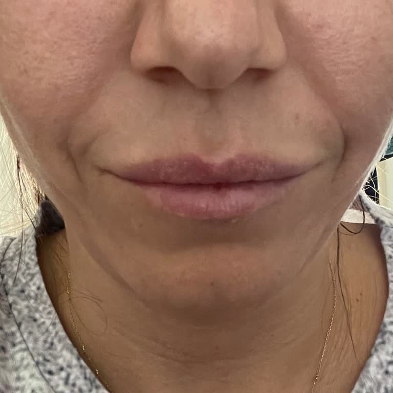 Fbm Tıp Merkezi Beklentilerin Altında Kalan Estetik Deneyimi