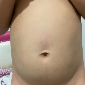 Bilge Şirinler Kreş Anaokulu Oğlum Sürekli Vücudunda Çiziklerle Geliyor