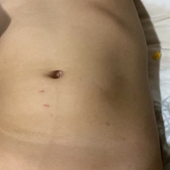 Bilge Şirinler Kreş Anaokulu Oğlum Sürekli Vücudunda Çiziklerle Geliyor