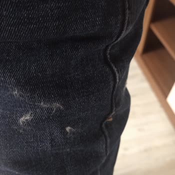 Elyaf Sorunu Yaşatan Mont