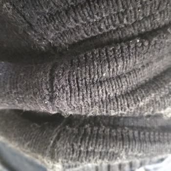 Elyaf Sorunu Yaşatan Mont