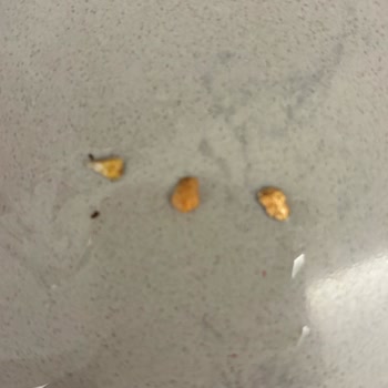 Paketli Yeşil Mercimekte Taş Sorunu: Sağlığımız Tehlikede!