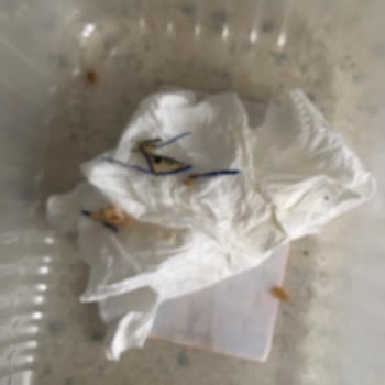 Erpiliç Piliç Parmak Köftede Plastik Şoku!