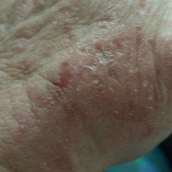 Fairy Deterjanı Ellerimde Sorun Yarattı