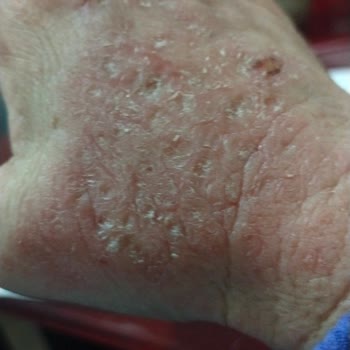 Fairy Deterjanı Ellerimde Sorun Yarattı